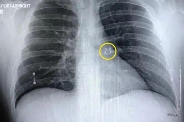 揭秘15个令人震惊的真实奇闻，挑战你的认知极限